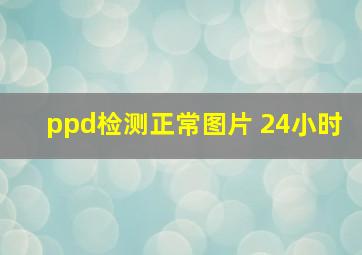 ppd检测正常图片 24小时